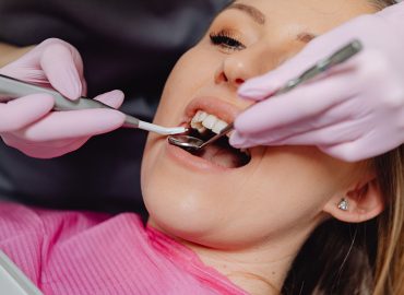 Servicio de Limpiezas dentales y profilaxis - Esthetic Dental Design 3